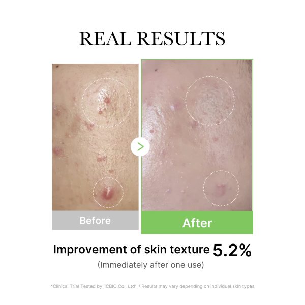 [GIFT] Exosome Cica Calming Ampoule