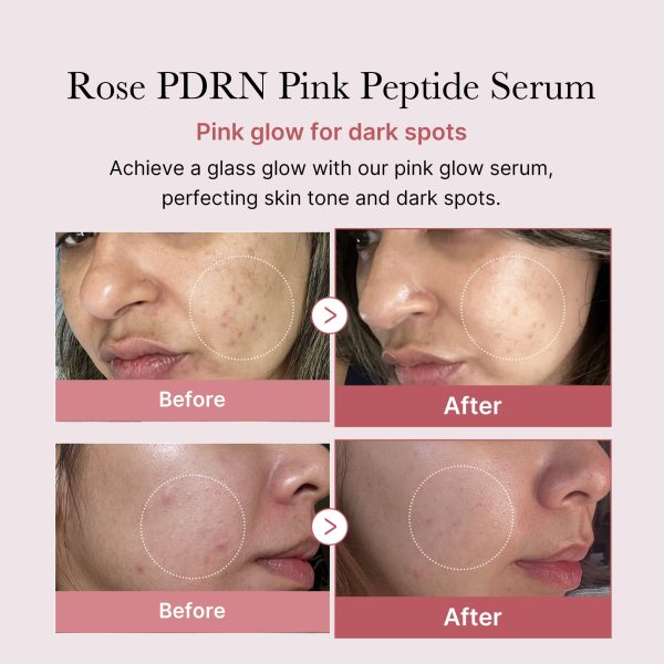 [GIFT] PDRN Pink Peptide Serum