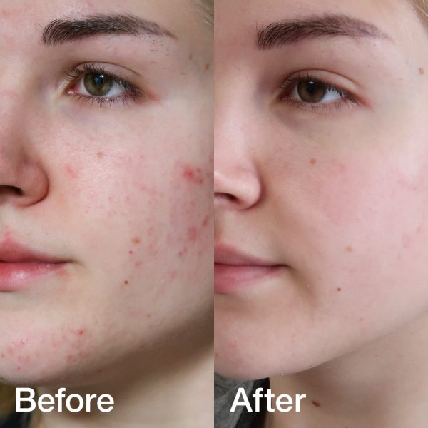 [GIFT] Red Line Full Set